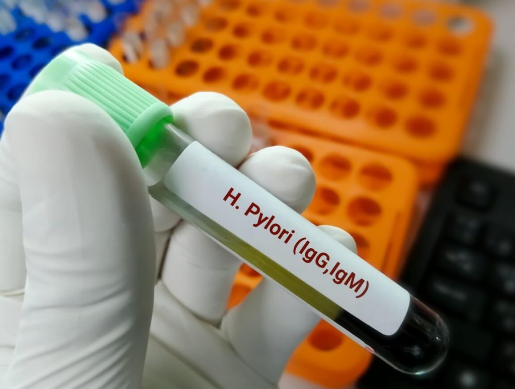 Diagnostyka zakażenia Helicobacter Pylori